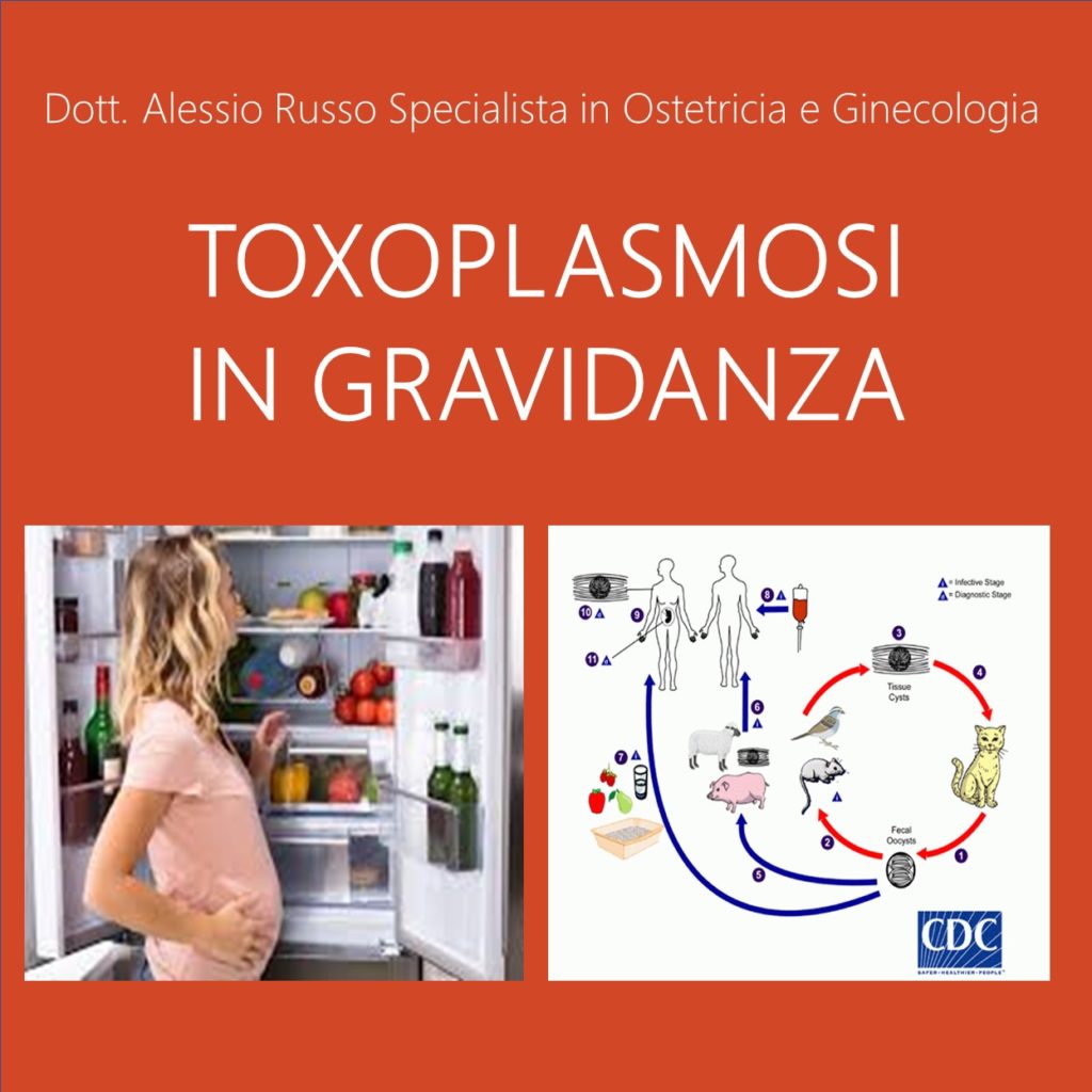 TOXOPLASMOSI IN GRAVIDANZA